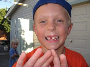 Read more about the article Gregory lost a tooth and wanted to share…
