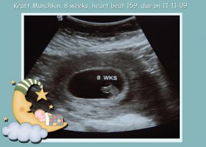 Read more about the article We are expecting! NOPE no APRIL FOOLS JOKE!