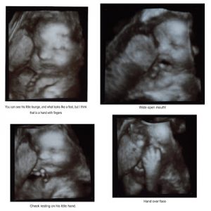 Read more about the article 32 weeks today! 8 WEEKS TO GO!