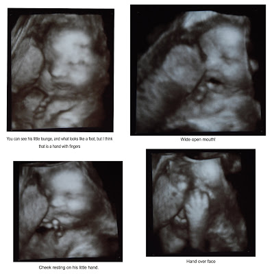 You are currently viewing 32 weeks today! 8 WEEKS TO GO!