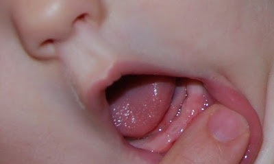 You are currently viewing A tooth already??