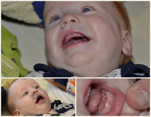 You are currently viewing I’d say he’s teething, would you?