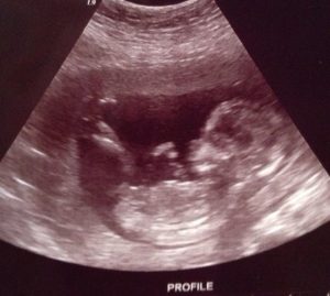 Read more about the article Baby update