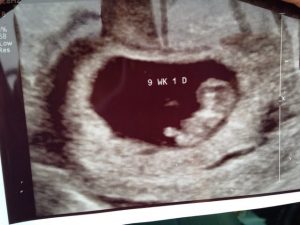 Read more about the article Baby number 6