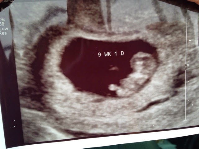 You are currently viewing Baby number 6